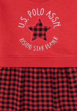 Kız Çocuk Kırmızı Örme Elbise - 50318089022